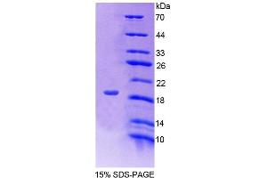 SDS-PAGE analysis of Human FKBP2 Protein. (FKBP2 蛋白)