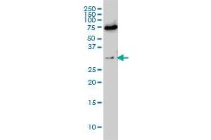 EXOSC8 monoclonal antibody (M01), clone 1G5 Western Blot analysis of EXOSC8 expression in Hela S3 NE . (EXOSC8 抗体  (AA 1-276))