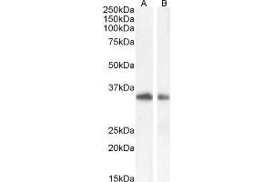 Western Blotting (WB) image for anti-Hepatitis A Virus Cellular Receptor 2 (TIM 3) (Internal Region) antibody (ABIN185571)