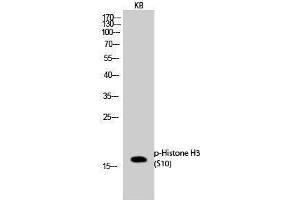 Western Blotting (WB) image for anti-Histone 3 (H3) (pSer10) antibody (ABIN3179450) (Histone 3 抗体  (pSer10))