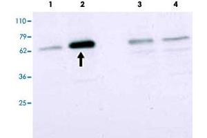 Western blot using SMAD2 polyclonal antibody  to detect over-expressed SMAD2 in COS cells (arrow). (SMAD2 抗体  (Internal Region))