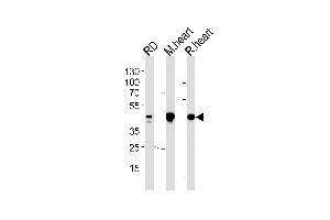 PDK2 Antibody (ABIN653784 and ABIN2843071) western blot analysis in RD cell line and mouse heart,rat heart lysates (35 μg/lane). (PDK2 抗体)