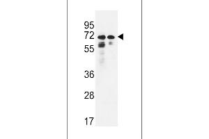 PNPLA8 Antibody (N-term) (ABIN650904 and ABIN2839989) western blot analysis in Hela,K562 cell line lysates (35 μg/lane). (PNPLA8 抗体  (N-Term))