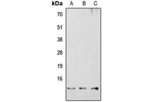 Western blot analysis of RBBP6 expression in HEK293T (A), Raw264.