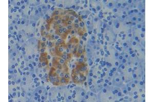 DAB staining on IHC-P; Samples: Human Pancreas Tissue (APRT 抗体  (AA 1-180))