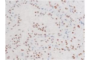 Immunohistochemistry (IHC) image for anti-Forkhead Box O4 (FOXO4) (pThr451) antibody (ABIN6256565)