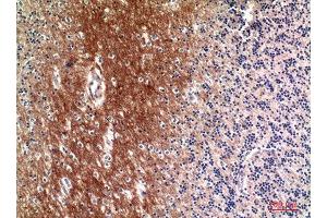 Immunohistochemistry (IHC) analysis of paraffin-embedded Human Brain, antibody was diluted at 1:100. (Complement C4A/C4B (Internal Region) 抗体)