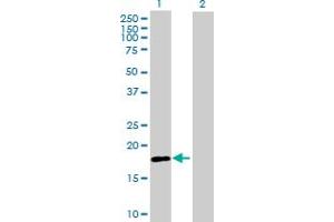 Western Blot analysis of RNF170 expression in transfected 293T cell line by RNF170 MaxPab polyclonal antibody. (RNF170 抗体  (AA 1-200))