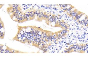 Detection of RBP2 in Human Small intestine Tissue using Monoclonal Antibody to Retinol Binding Protein 2, Cellular (RBP2) (RBP2 抗体  (AA 1-134))