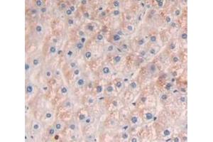Immunohistochemistry (IHC) image for anti-Collagen, Type I, alpha 1 (COL1A1) (AA 1218-1440) antibody (ABIN7443392)