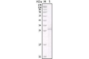 Western Blotting (WB) image for anti-Receptor tyrosine-protein kinase erbB-2 (ErbB2/Her2) antibody (ABIN1845273) (ErbB2/Her2 抗体)