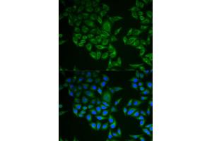 Immunofluorescence analysis of A549 cells using CD247 antibody (ABIN5971089). (CD247 抗体)