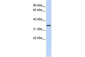 ZNF660 antibody used at 0. (ZNF660 抗体  (N-Term))