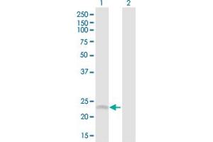 Western Blot analysis of SRD5A1 expression in transfected 293T cell line by SRD5A1 MaxPab polyclonal antibody. (SRD5A1 抗体  (AA 1-259))