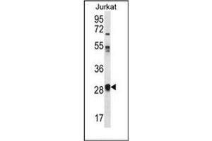 Western blot analysis of OR11L1 Antibody (C-term) in Jurkat cell line lysates (35ug/lane). (OR11L1 抗体  (C-Term))