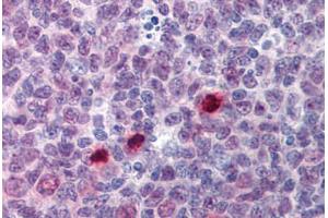 Human Tonsil, Mitotic Figures: Formalin-Fixed, Paraffin-Embedded (FFPE) (Separase 抗体  (AA 586-702))