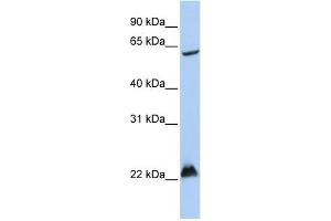 WB Suggested Anti-MGRN1 Antibody Titration:  0. (Mahogunin RING Finger Protein 1 抗体  (Middle Region))