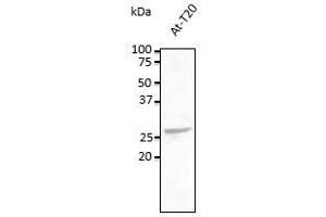 Anti-Rab5c Ab at 1/500 dilution, lysates at 100 µg per Iane, rabbit polyclonal to goat lgG (HRP) at 1/10,000 dilution, (Rab5c 抗体  (C-Term))