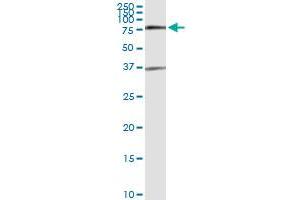 Immunoprecipitation of SMAD6 transfected lysate using anti-SMAD6 MaxPab rabbit polyclonal antibody and Protein A Magnetic Bead , and immunoblotted with SMAD6 purified MaxPab mouse polyclonal antibody (B01P) . (SMAD6 抗体  (AA 1-496))