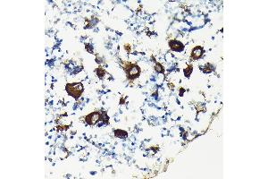 Immunohistochemistry of paraffin-embedded rat bone marrow using Integrin beta 3 (ITGB3/CD61) Rabbit pAb (ABIN6127572, ABIN6142584, ABIN6142586 and ABIN6219636) at dilution of 1:100 (40x lens). (Integrin beta 3 抗体  (AA 610-718))