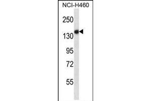 TLR8 Antibody (Center) (ABIN657933 and ABIN2846877) western blot analysis in NCI- cell line lysates (35 μg/lane). (TLR8 抗体  (AA 434-463))