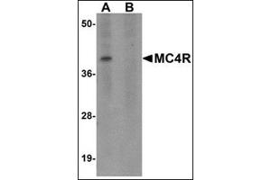 Western blot analysis of MC4R in rat brain tissue lysate with this product at 1 μg/ml in (A) the absence and (B) the presence of blocking peptide. (MC4R 抗体  (N-Term))