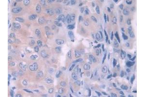 Used in DAB staining on fromalin fixed paraffin- embedded kidney tissue
