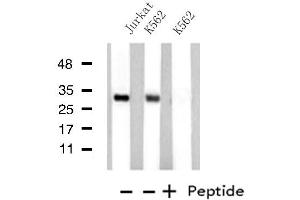 Western blot analysis of extracts from Jurkat/K562 cells, using MED8 antibody. (MED8 抗体  (C-Term))