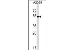 NHEDC2 Antibody (C-term) (ABIN1537363 and ABIN2849310) western blot analysis in  cell line lysates (35 μg/lane). (NHEDC2 抗体  (C-Term))