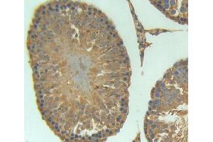 Used in DAB staining on fromalin fixed paraffin- embedded testis tissue (AVPI1 抗体)