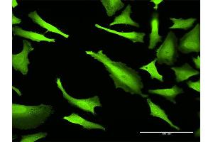 Immunofluorescence (IF) image for anti-ATP-Binding Cassette, Sub-Family C (CFTR/MRP), Member 2 (ABCC2) (AA 214-313) antibody (ABIN514490)