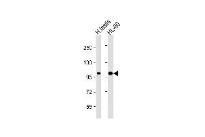 All lanes : Anti-SENP6 Antibody  at 1:1000 dilution Lane 1: human testis lysate Lane 2: HL-60 whole cell lysate Lysates/proteins at 20 μg per lane. (SENP6 抗体  (C-Term))