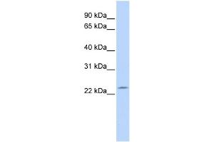WB Suggested Anti-RP11-529I10. (DPCD 抗体  (N-Term))