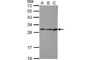WB Image Sample (30 ug of whole cell lysate) A: PC-3 B: U87-MG C: SK-N-SH 12% SDS PAGE antibody diluted at 1:1000