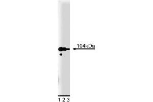 Western blot analysis of Adaptin gamma on PC12 cell lysate. (gamma 1 Adaptin 抗体  (AA 642-821))
