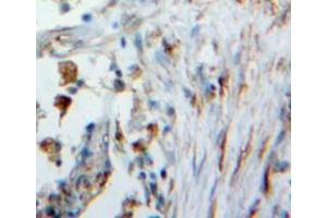 Used in DAB staining on fromalin fixed paraffin-embedded lung tissue (WFDC1 抗体  (AA 24-208))