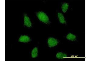 Immunofluorescence of purified MaxPab antibody to TRIM62 on HeLa cell. (TRIM62 抗体  (AA 1-475))