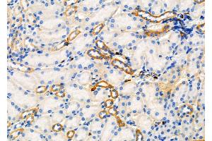 ABIN6265877 and ABIN6277916 at 1/100 staining Mouse kidney tissue by IHC-P. (UGT2B17 抗体  (N-Term))