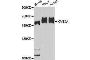 Western blot analysis of extracts of various cell lines, using KMT2A antibody. (MLL/KMT2A 抗体)
