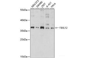 Western blot analysis of extracts of various cell lines using FBXL12 Polyclonal Antibody at dilution of 1:1000. (FBXL12 抗体)
