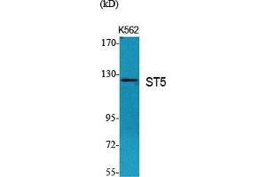 Western Blot (WB) analysis of specific cells using ST5 Polyclonal Antibody. (ST5 抗体  (Internal Region))