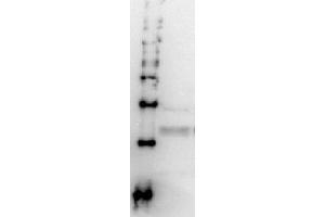 Western Blotting (WB) image for anti-Proteasome (Prosome, Macropain) 26S Subunit, Non-ATPase, 8 (PSMD8) antibody (ABIN2452112)