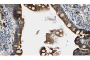 ABIN6268678 at 1/100 staining Mouse intestine tissue by IHC-P. (GJB1 抗体  (Internal Region))