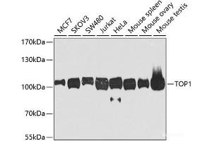 Western blot analysis of extracts of various cell lines using TOP1 Polyclonal Antibody at dilution of 1:1000. (Topoisomerase I 抗体)