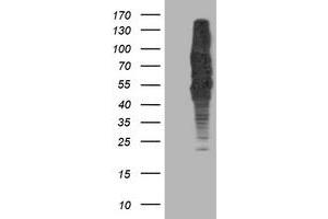 Western Blotting (WB) image for anti-Dihydrolipoamide Dehydrogenase (DLD) antibody (ABIN1497846) (DLD 抗体)