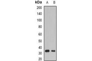 Western blot analysis of SSX5 expression in Raji (A), mouse skeletal muscle (B) whole cell lysates. (SSX5 抗体)