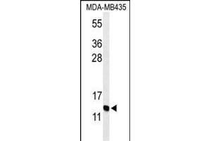 Western blot analysis of GNRH2 Antibody (Center) (ABIN653741 and ABIN2843043) in MDA-M cell line lysates (35 μg/lane). (GnRH2 抗体  (AA 26-53))