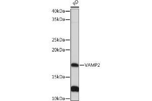 Western blot analysis of extracts of RD cells, using V Rabbit mAb (ABIN7271313) at 1:1000 dilution. (VAMP2 抗体)