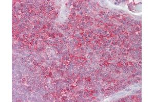 Anti-KIF2A antibody IHC of human thymus. (KIF2A 抗体  (AA 72-121))