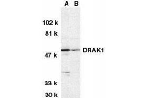 Western blot analysis of DRAK1 in (A) MOLT4 and (B) A431 whole cell lysates with AP30302PU-N DRAK1 antibody at 1 μg/ml. (STK17A 抗体  (N-Term))